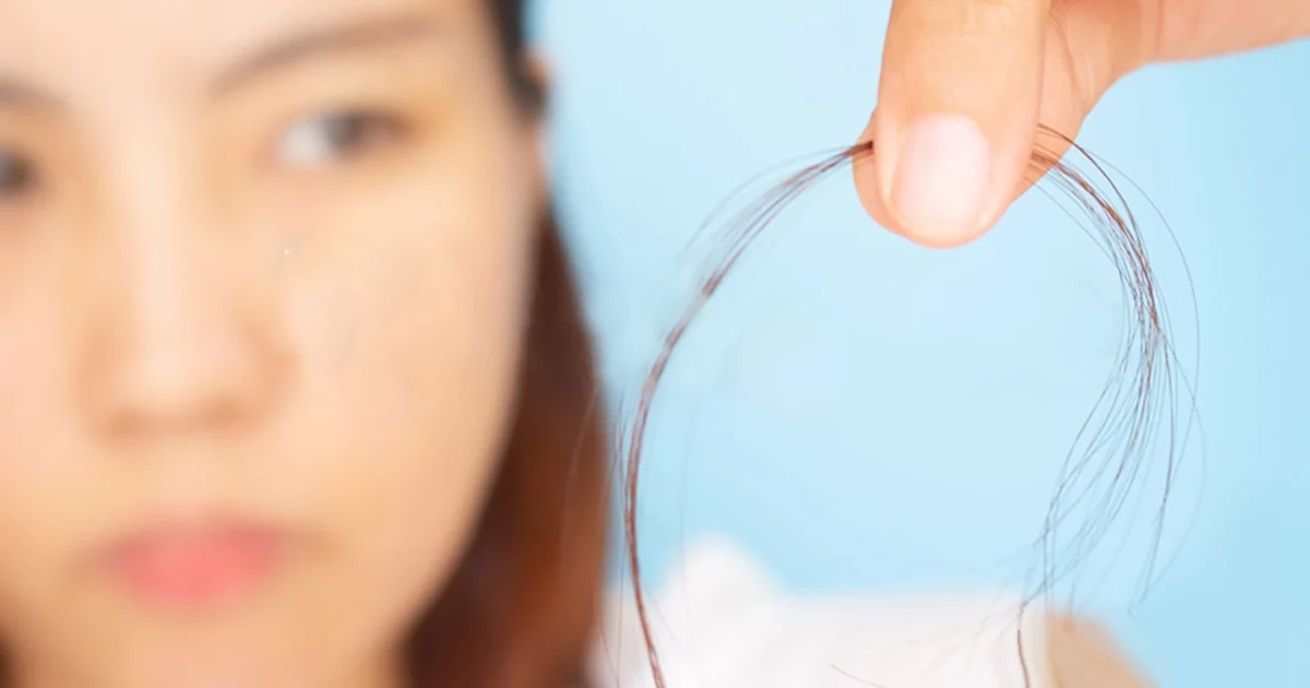 How To Minimize Stress Related Hair Loss