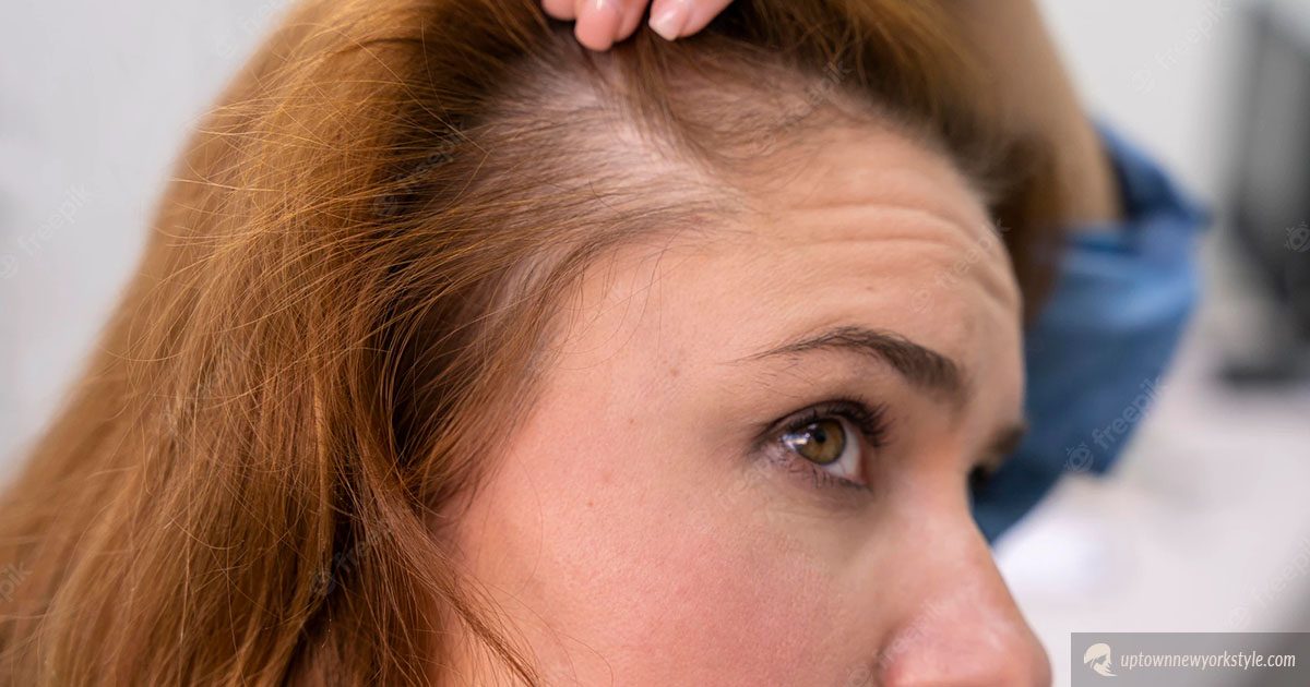 Can Hair Color Cause Hair Loss?