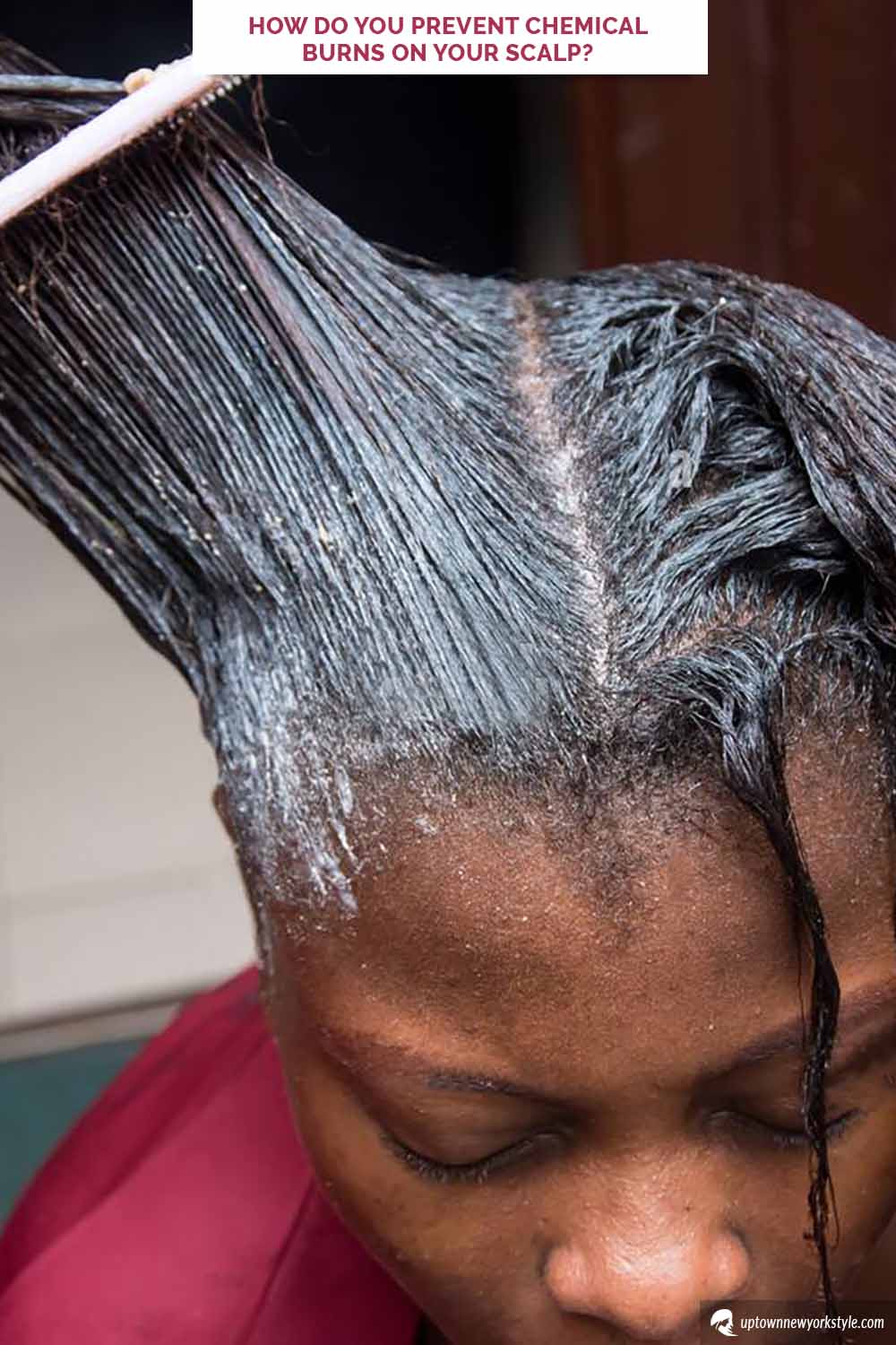 How Do You Prevent Chemical Burns On Your Scalp?
